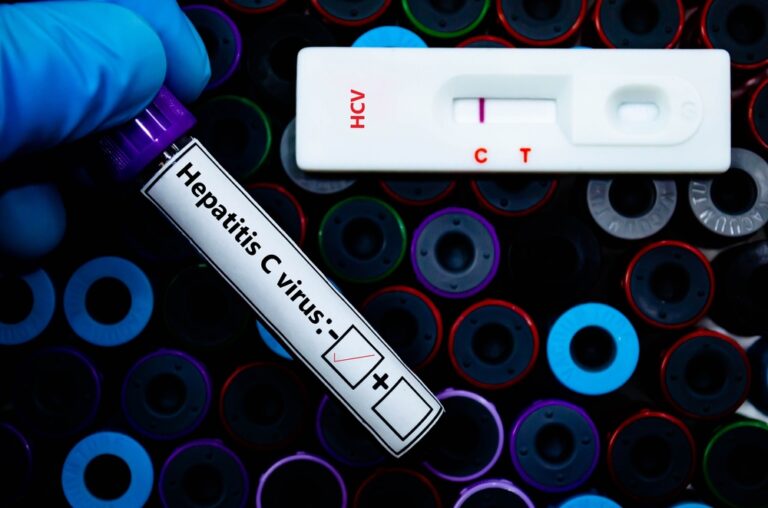 ADH_Hepatitis C