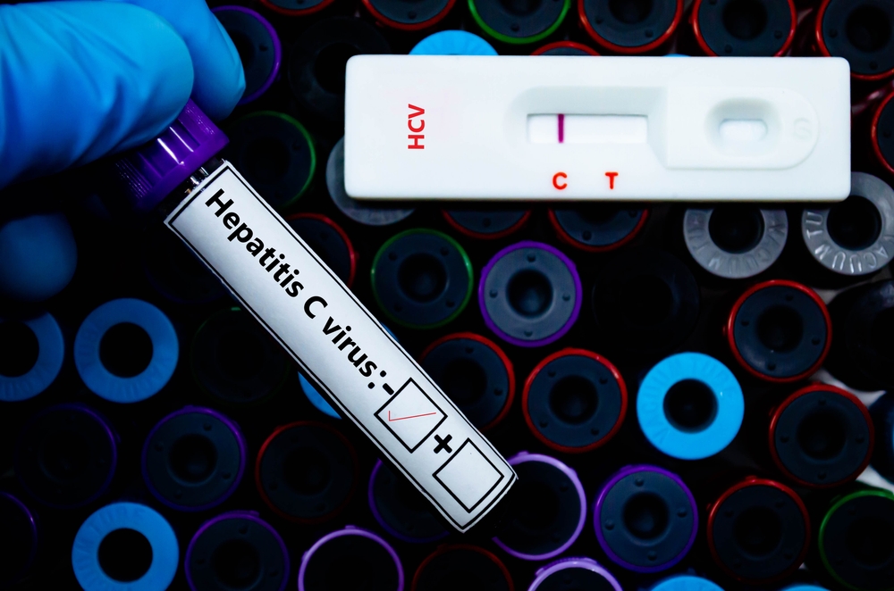 ADH_Hepatitis C